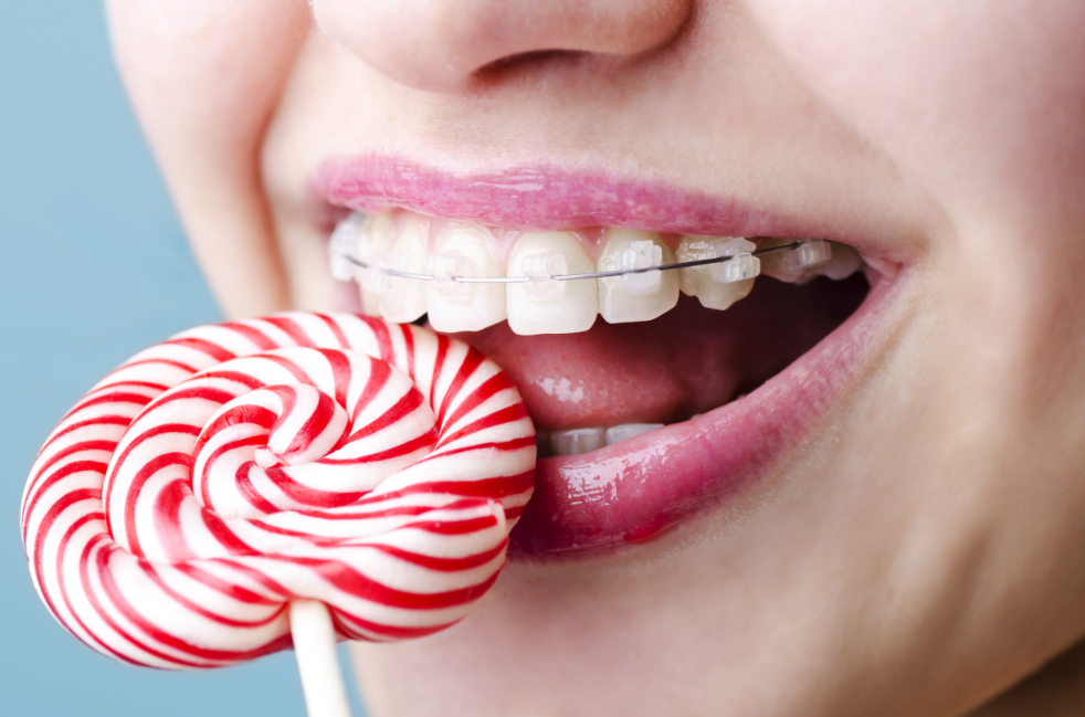 Ortodoncia Dental Zihuatanejo Tu salud es nuestro mayor compromiso